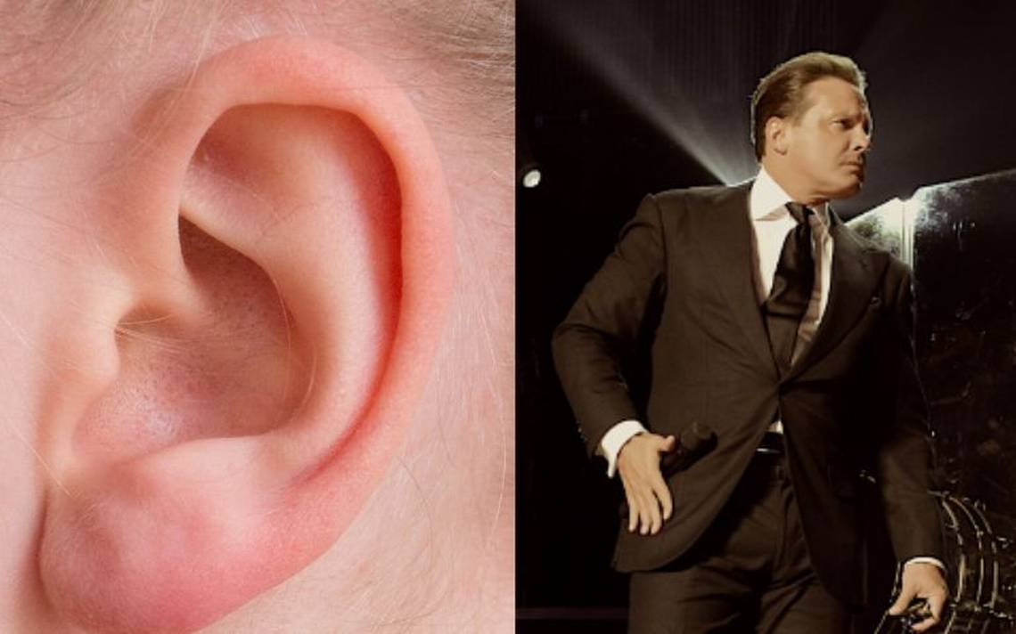 Se revela que Luis Miguel continúa con su problema del oído